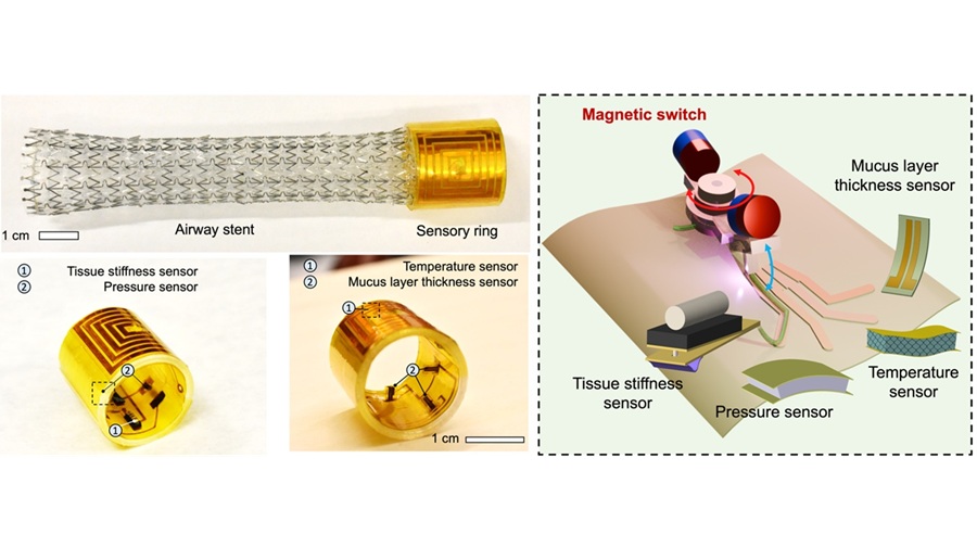 Imagen: Stent de vía aérea sensorial sin chip ni batería activado por un interruptor magnético en miniatura (Yusheng Wang et al., Science Advances (2026). DOI:10.1126/sciadv.aed3998)