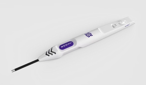 Imagen: El estimulador de nervios Evala es un sistema intraoperatorio portátil para una rápida identificación de nervios y evaluación funcional en todos los tamaños de nervios (fotografía cortesía de Epineuron) Imagen: El estimulador de nervios Evala es un sistema intraoperatorio portátil para una rápida identificación de nervios y evaluación funcional en todos los tamaños de nervios (fotografía cortesía de Epineuron)