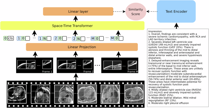 Imagen: El codificador visual procesa secuencias de imágenes CMR y el codificador de texto procesa el texto de la sección “impresión” de los informes correspondientes (Nakashima, M., Qiu, J., Huang, P. et al. Nature Communications (2026). https://doi.org/10.1038/s41467-026-73022-2)