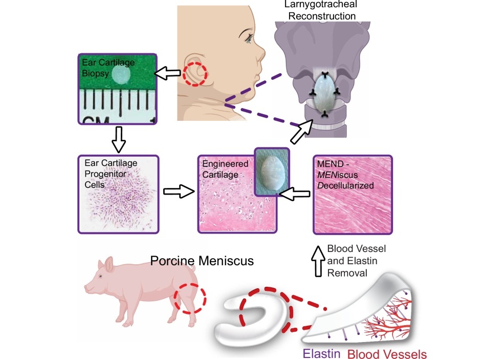 Imagen: Esquema conceptual de MEND en combinación con eCPC para la reconstrucción laringotraqueal (Gehret, P., Ali Akbari Ghavimi, S., Dumas, A.A. et al.Nature Communications (2026). DOI: 10.1038/s41467-026-73680-2)