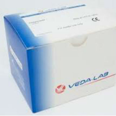 PRUEBA RÁPIDA DE STREP PNEUMONIAE
