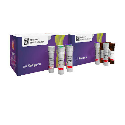 PRUEBA DE VITAMINA D