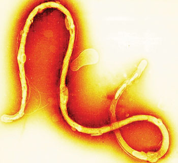 Imagen: Microfotografía electrónica de barrido de la espiroqueta, Borrelia burgdorferi, una bacteria larga, delgada que típicamente toma una forma en espiral. La infección con esta bacteria causa la enfermedad de Lyme (Fotografía cortesía de Tina Carvalho).