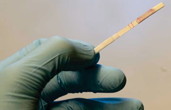 Imagen: Las pruebas de sangre Octava, desarrolladas para la detección rápida, exacta del cáncer de mama (Fotografía cortesía de Eventus Diagnostics). Imagen: Las pruebas de sangre Octava, desarrolladas para la detección rápida, exacta del cáncer de mama (Fotografía cortesía de Eventus Diagnostics).
