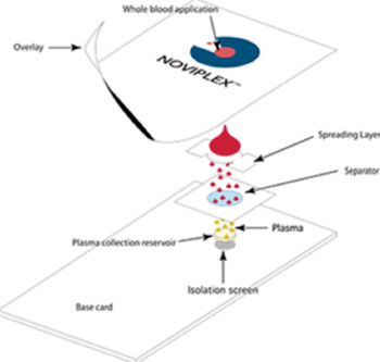 Imagen: La Tarjeta Noviplex – una tecnología de próxima generación para la recolección de muestras – permite acelerar la obtención y el análisis de plasma sanguíneo (Fotografía cortesía de Shimadzu Scientific Instruments).