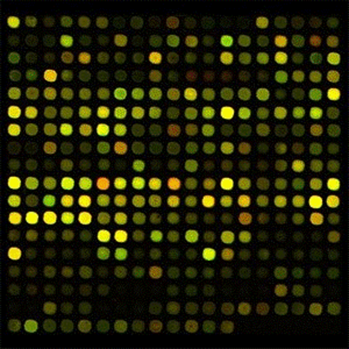 Imagen: Los investigadores utilizaron microarrays para medir simultáneamente las concentraciones de cientos de moléculas e identificar los patrones de expresión de microARN pertinentes que podrían ayudar a diagnosticar el cáncer de mama de manera no invasiva (Fotografía cortesía del Centro Médico Universitario de Friburgo).