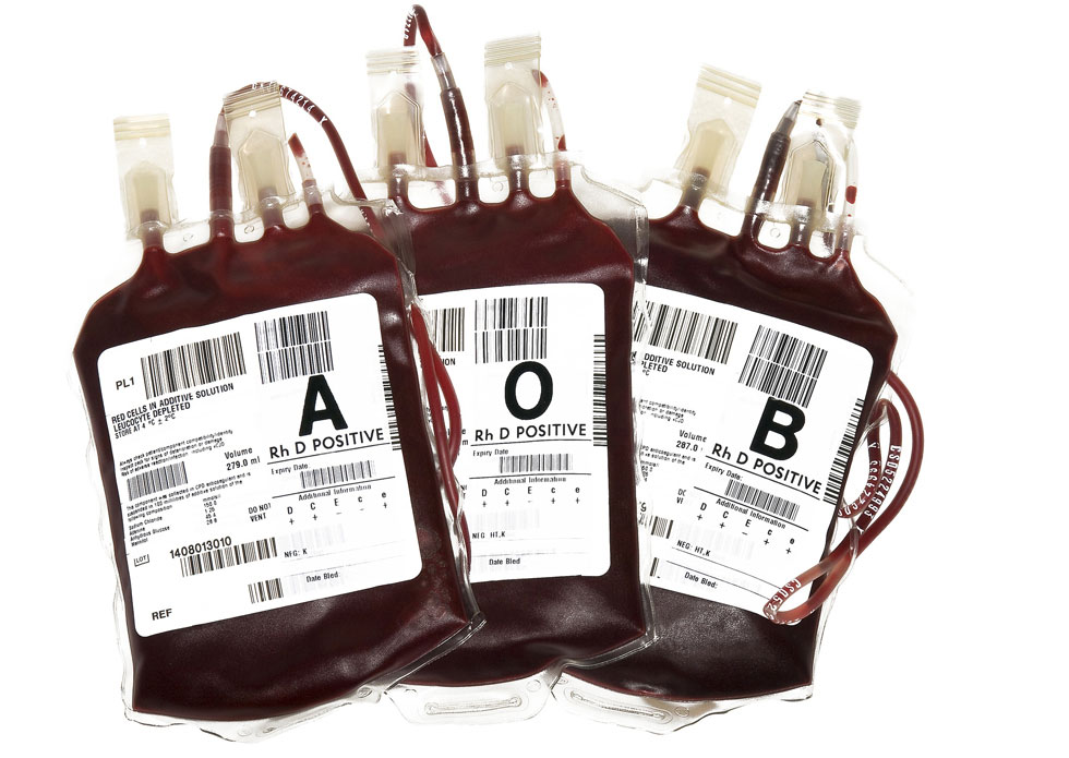 Imagen: Bolsas de transfusión de sangre que contienen diferentes tipos de sangre (Fotografía cortesía de Terinah DoBa).