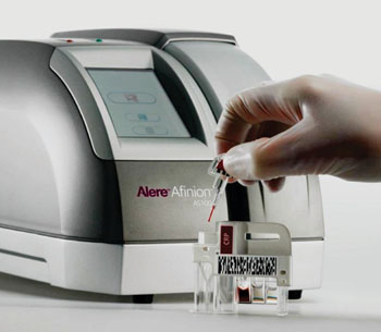 Imagen: El cartucho de análisis para la proteína C-reactiva (PCR) Afinion y el analizador Afinion AS100 (Fotografía cortesía de Alere).