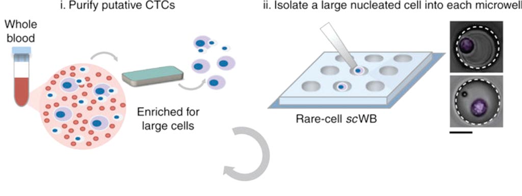 Imagen: Flujo de trabajo microfluídico de células-raras para la inmunotransferencia western multiplexada de CTC derivadas de pacientes (Fotografía cortesía de Universidad de California - Berkeley).