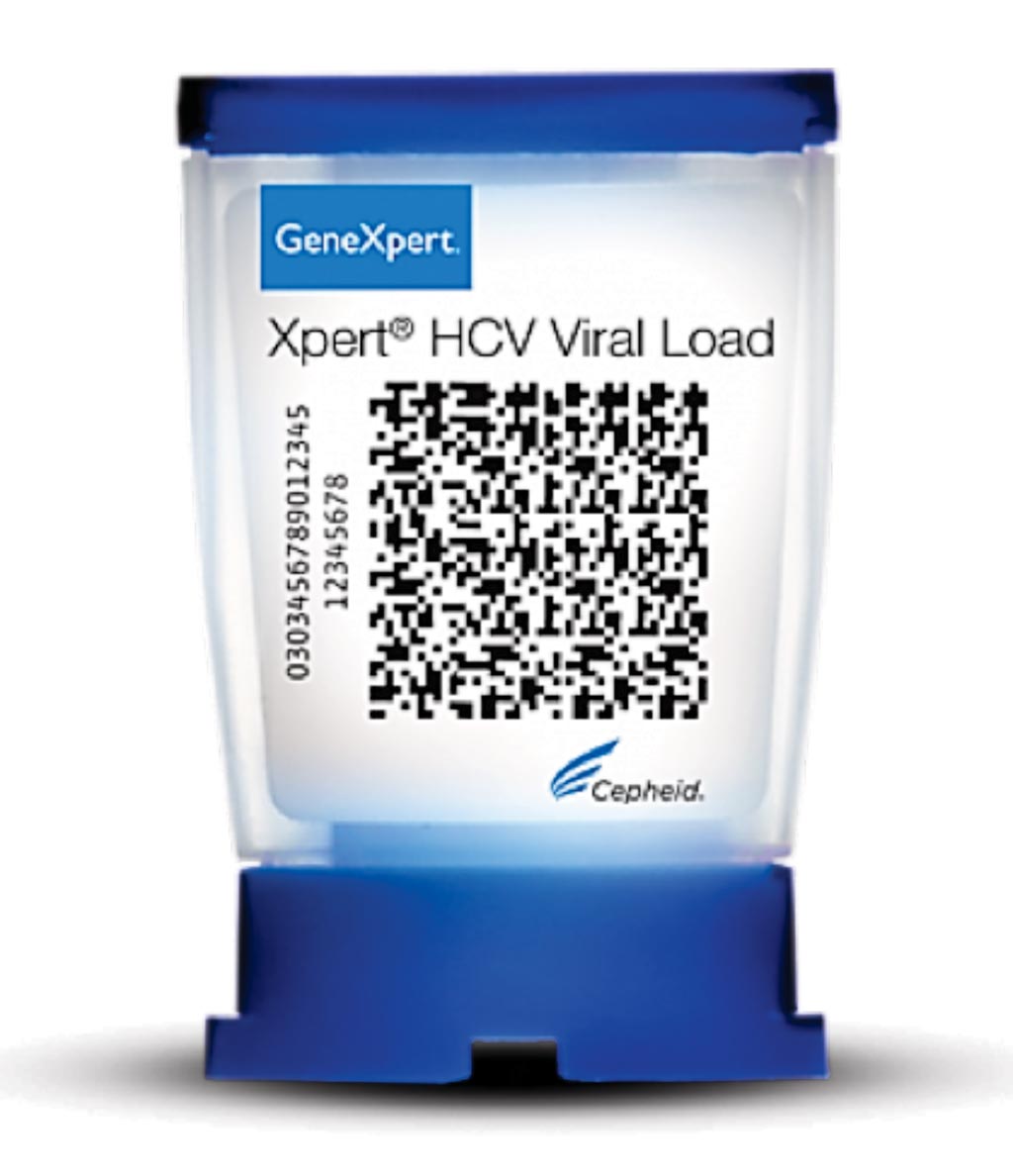 El cartucho de Carga Viral Xpert HCV, una prueba cuantitativa que proporciona pruebas moleculares, según necesidad, para la confirmación de la infección y el seguimiento del virus de la hepatitis C (HCV) (Fotografía cortesía de Cepheid).