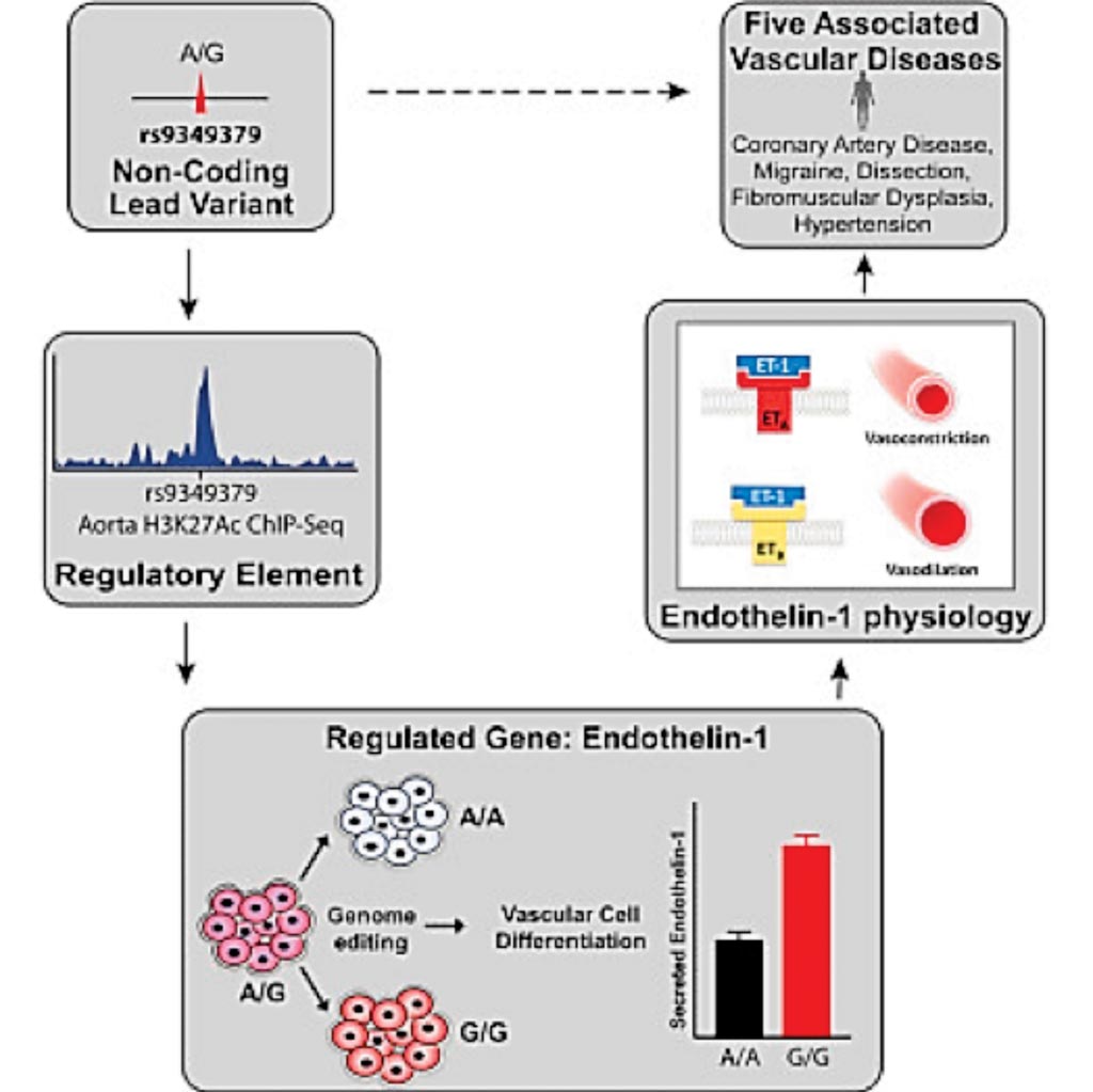 Imagen: Un diagrama de una variante genética asociada con cinco enfermedades vasculares es un regulador distal de la expresión del gen de la endotelina-1 (Fotografía cortesía del Instituto Broad del MIT y la Universidad de Harvard).