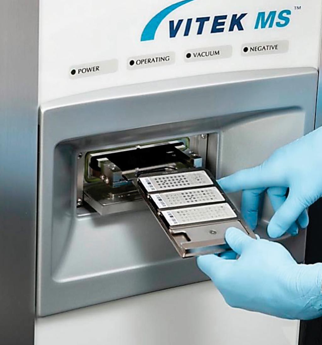 Imagen: El Sistema de Espectrometría de Masas MALDI-TOF1 VITEK MS, un sistema automatizado de identificación microbiana (Fotografía cortesía de bioMérieux).