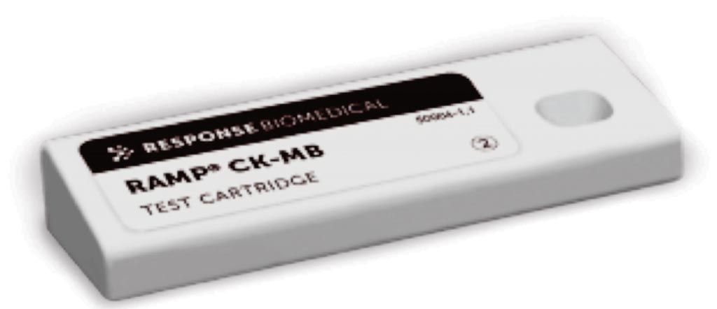 Imagen: Una prueba de diagnóstico rápido para la determinación de los niveles elevados de CK-MB en la sangre, que algunos científicos sugieren puede ser innecesaria (Fotografía cortesía de Response Biomedical).