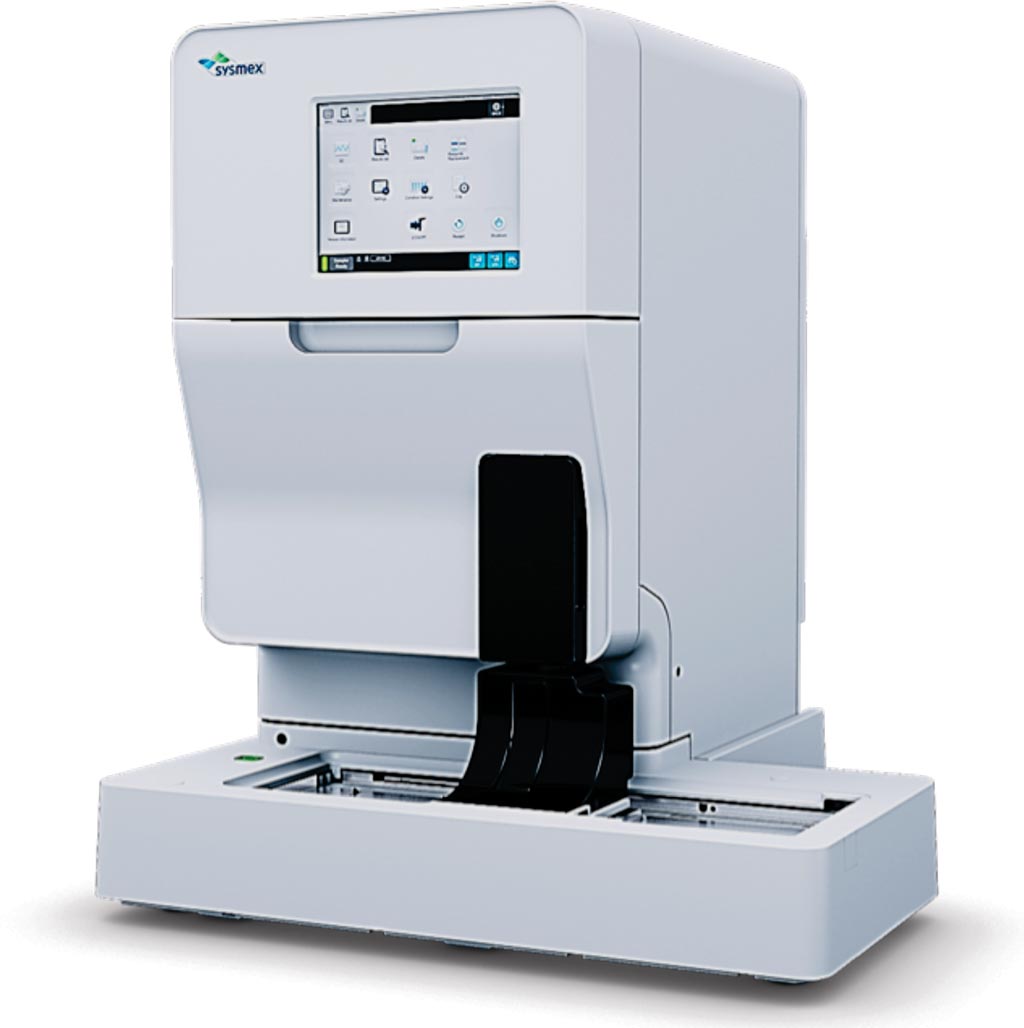 Imagen: El analizador de orina totalmente automatizado UF-5000 (Fotografía cortesía de Sysmex Europa).