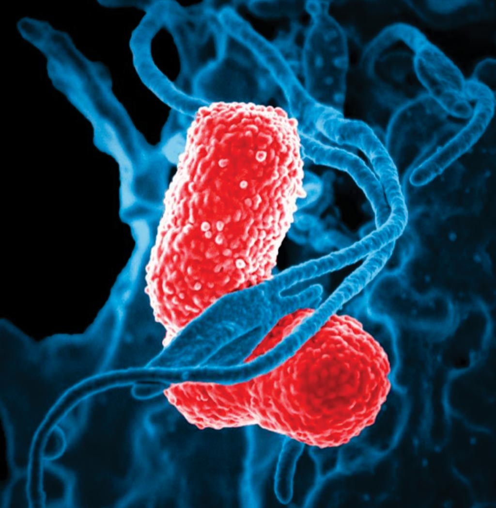 Imagen: La microfotografía electrónica de barrido digitalmente coloreada (SEM) representa un glóbulo blanco humano (WBC) de color azul, conocido específicamente como un neutrófilo, que interactúa con dos bacterias de Klebsiella pneumoniae multirresistentes, de color rosa, en forma de bastón, (MDR) (Fotografía cortesía de los CDC).