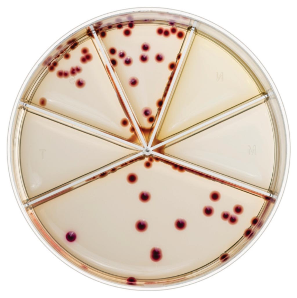 Imagen: El kit Flexicult SSI-Urinary es un agar cromogénico que permite la identificación, la cuantificación y la realización de pruebas de susceptibilidad de los patógenos del tracto urinario (Fotografía cortesía de SSI DIagnostica).