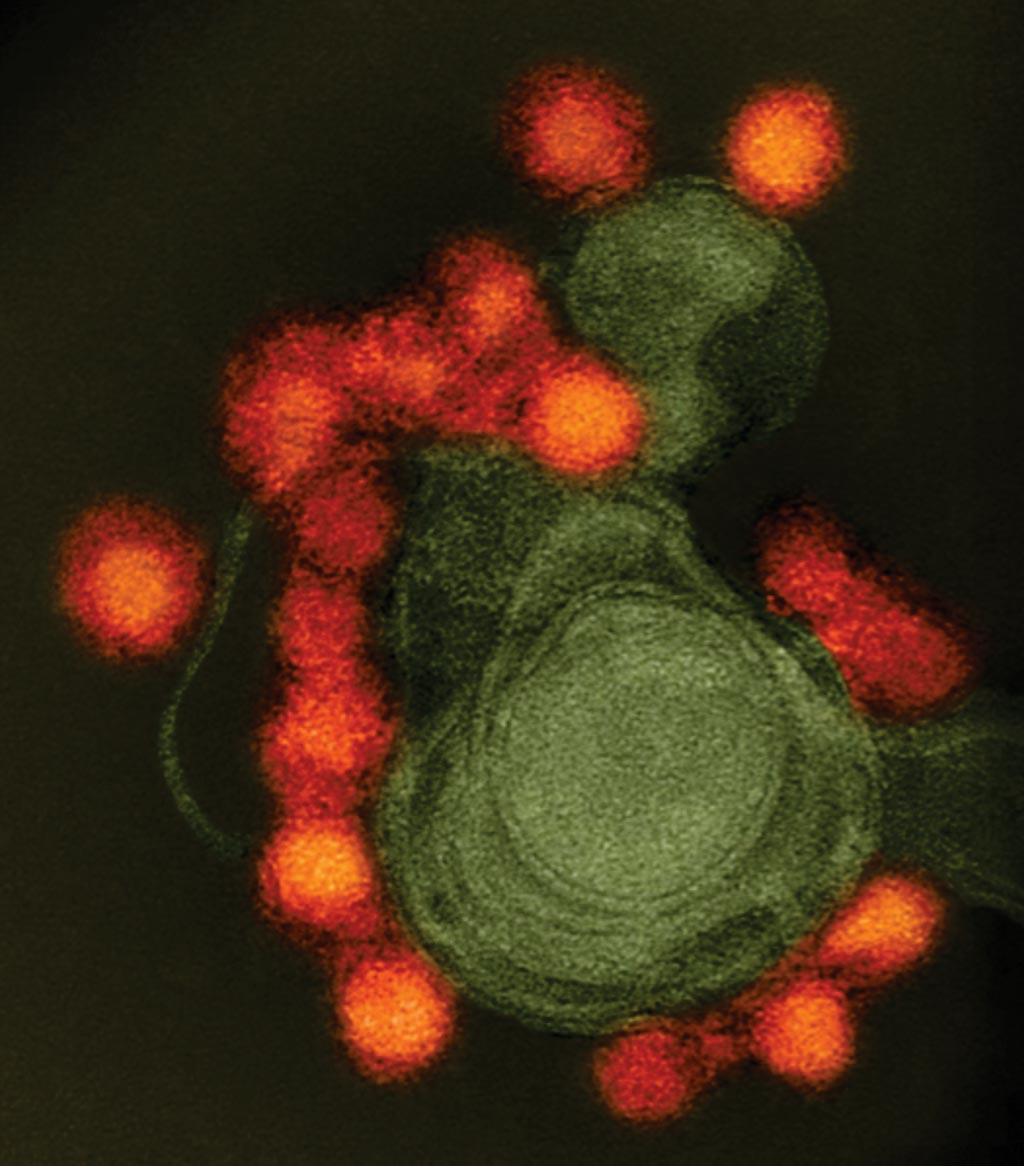 Imagen: Esta fotomicrografía electrónica de transmisión muestra un virus de Zika de cepa Fortaleza con coloración negativa (rojo) (Fotografía cortesía de los Institutos Nacionales de Salud de EUA).