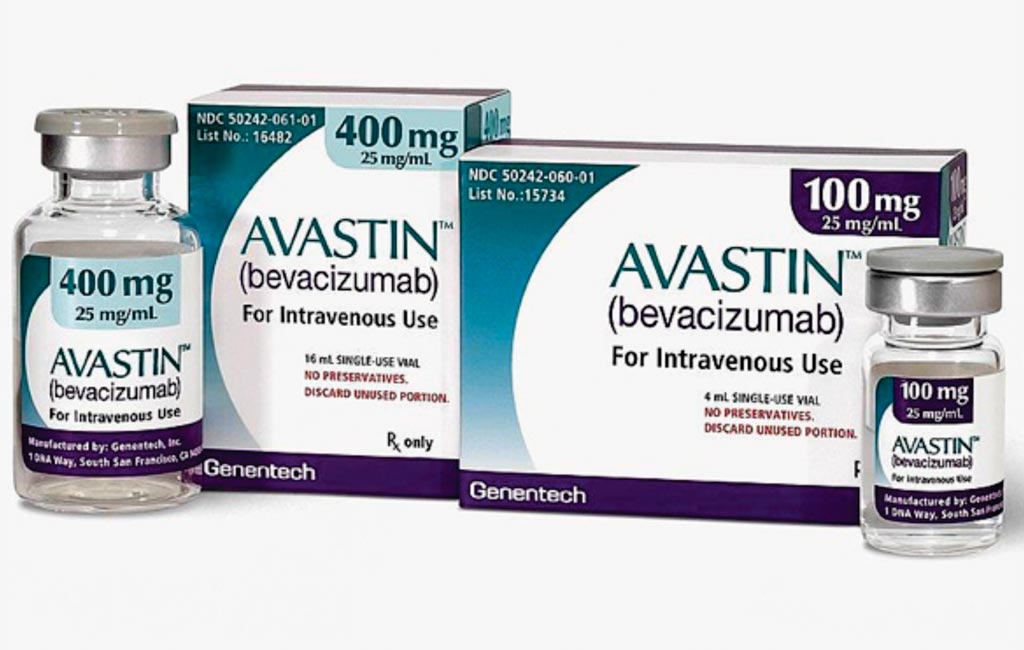 Imagen: El bevacizumab (Avastin) es un medicamento aprobado para la inmunoterapia en los pacientes con carcinoma metastásico de células renales, glioblastoma, cáncer de pulmón no microcítico no escamoso y con cáncer colorrectal metastásico, además del cáncer de cuello uterino (Fotografía cortesía de Genentech).