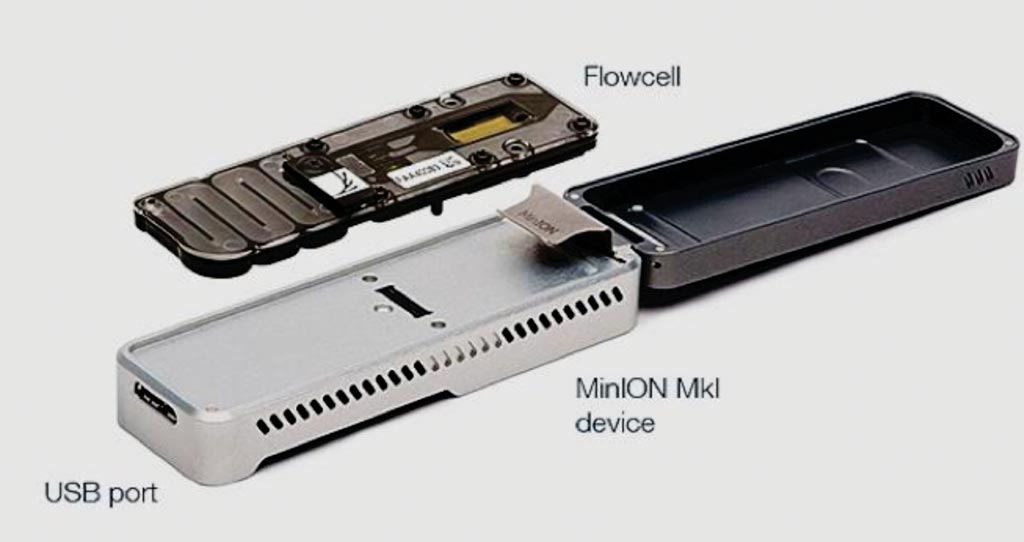 Imagen: El MinION es el único dispositivo portátil en tiempo real para la secuenciación de ADN y ARN (Fotografía cortesía de Oxford Nanopore Technologies).
