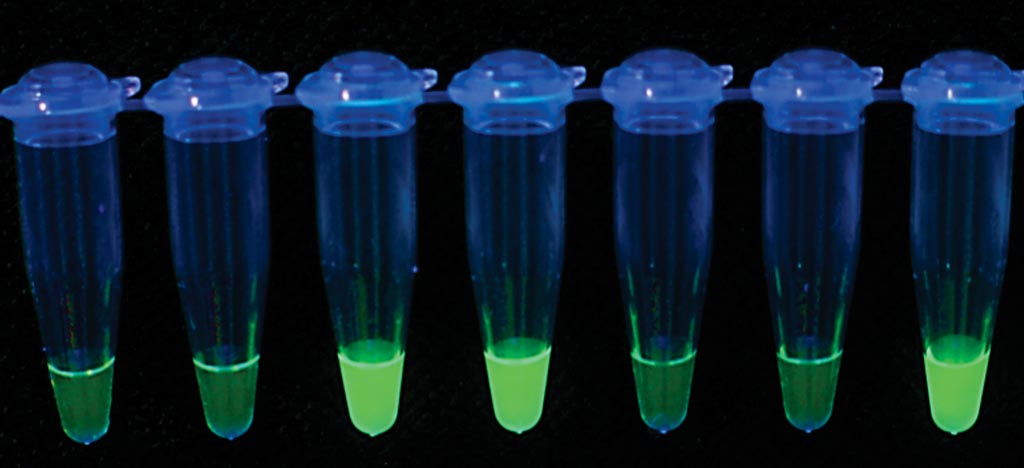 Imagen: Resultados de una prueba LAMP que muestra muestras con resultados positivos que emiten fluorescencia verde (Fotografía cortesía de la Foundation for Innovative New Diagnostics).