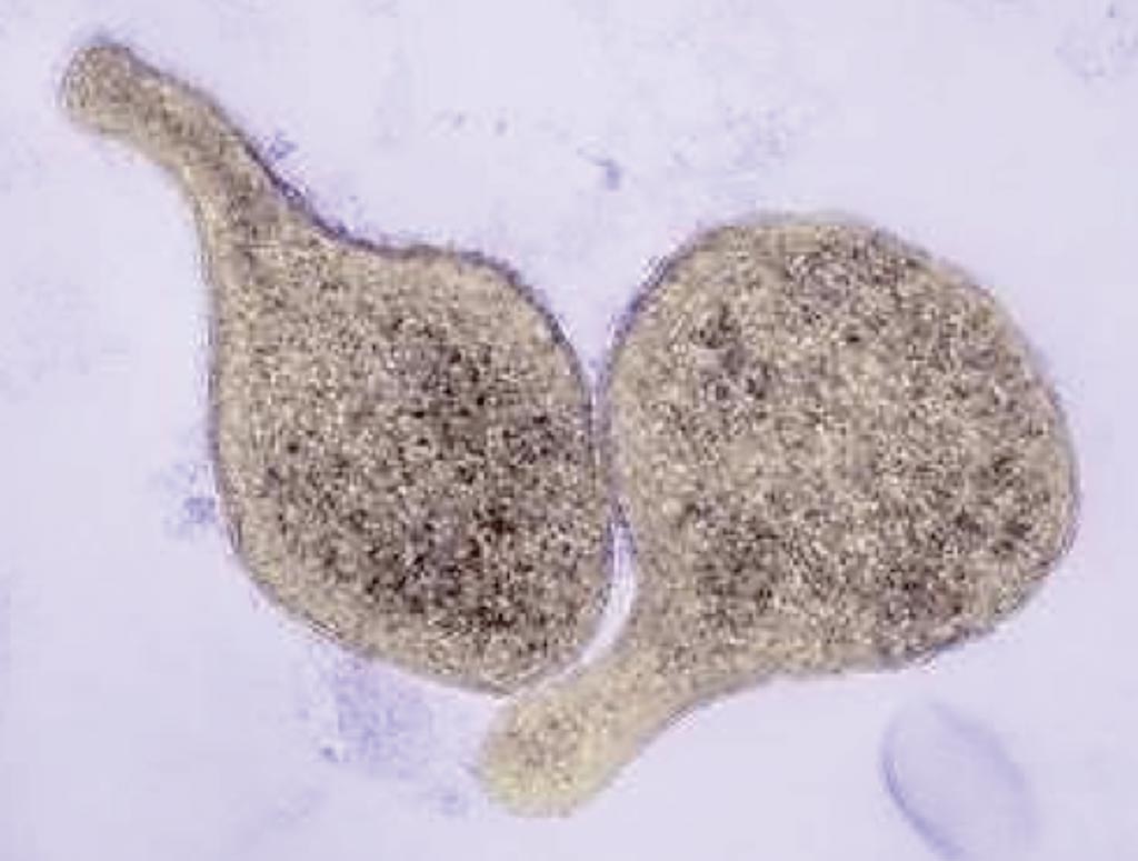 Imagen: Una microfotografía electrónica de barrido (SEM) de Mycoplasma genitalium, que es una causa común de infecciones de transmisión sexual, ocupando el segundo lugar en prevalencia detrás de Chlamydia trachomatis (Fotografía cortesía de Thomas Deerinck, NCMIR).