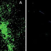 Imagen: Mycobacterium leprae coloreada con auramina en un corte de tejido FFPE observada con el objetivo × 40 del microscopio de fluorescencia de diodos emisores de luz A: muestra con alto BI; B. Muestra con bajo BI (Fotografía cortesía del Instituto de Investigación Armauer Hansen).