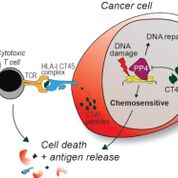 Imagen: El CT45, un marcador biomarcador que se encuentra en algunas células de cáncer de ovario, se asocia con una supervivencia prolongada sin enfermedad en mujeres con cáncer de ovario avanzado (Fotografía cortesía del Centro Médico de la Universidad de Chicago).