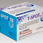Imagen: La prueba T-SPOT.TB es una prueba de sangre única y de una sola visita para detectar la tuberculosis (TB), también conocida como análisis de liberación de interferón gamma (IGRA) (Fotografía cortesía de Oxford Immunotec).