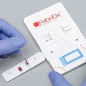 Imagen: FebriDx proporciona a los médicos una evaluación en 10 minutos de la respuesta inmune del cuerpo a una infección respiratoria aguda (IRA) directamente a partir de una muestra de sangre de punción digital (Fotografía cortesía de RPS Diagnostics).