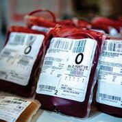 Imagen: Las víctimas de traumas mayores que reciben transfusiones de glóbulos rojos empaquetados de 22 días de edad o más pueden enfrentar un riesgo aumentado de muerte dentro de las 24 horas siguientes (Fotografía cortesía de South West London Pathology).