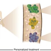 Imagen: La heterogeneidad tumoral, la evolución clonal y la resistencia a la terapia se pudieron revelar mediante el análisis de células individuales de pacientes con mieloma múltiple (Fotografía cortesía del Instituto de Ciencia Weizmann).