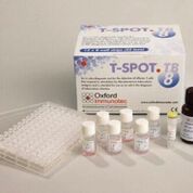 Imagen: El kit de prueba de diagnóstico para la tuberculosis, ELISpot TB (Fotografía cortesía de Oxford Immunotec).