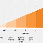 Imagen: Los niveles de procalcitonina (PCT) y su relación con la sepsis clínica y el shock séptico (Fotografía cortesía de Technology Networks).