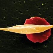 Imagen: Una microfotografía electrónica de barrido (SEM) que muestra células falciformes largas frente a más glóbulos rojos normales en forma de disco (Fotografía cortesía de Wellcome Trust).