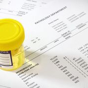 Imagen: Las nuevas directrices pueden ayudar a disminuir el uso de antimicrobianos que promueven el desarrollo de resistencia por parte de los patógenos (Fotografía cortesía de Shutterstock). Imagen: Las nuevas directrices pueden ayudar a disminuir el uso de antimicrobianos que promueven el desarrollo de resistencia por parte de los patógenos (Fotografía cortesía de Shutterstock).