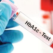 Imagen: La prueba de hemoglobina glucosilada o HbA1c no se debe utilizar únicamente para determinar la prevalencia de la diabetes (Fotografía cortesía de la Fundación de Alberta para la Diabetes).