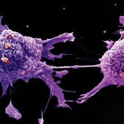 Imagen: Una microfotografía electrónica de barrido (SEM) de células de cáncer de pulmón (Fotografía cortesía de Cancer Research UK).