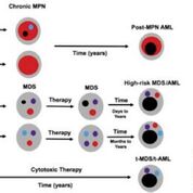 Imagen: Un modelo para establecer el impacto de la frecuencia de alelo variante de TP53 en la progresión de la enfermedad en los casos de neoplasias mieloides (Fotografía cortesía del Centro de Cáncer e Instituto de Investigación Lee Moffitt).