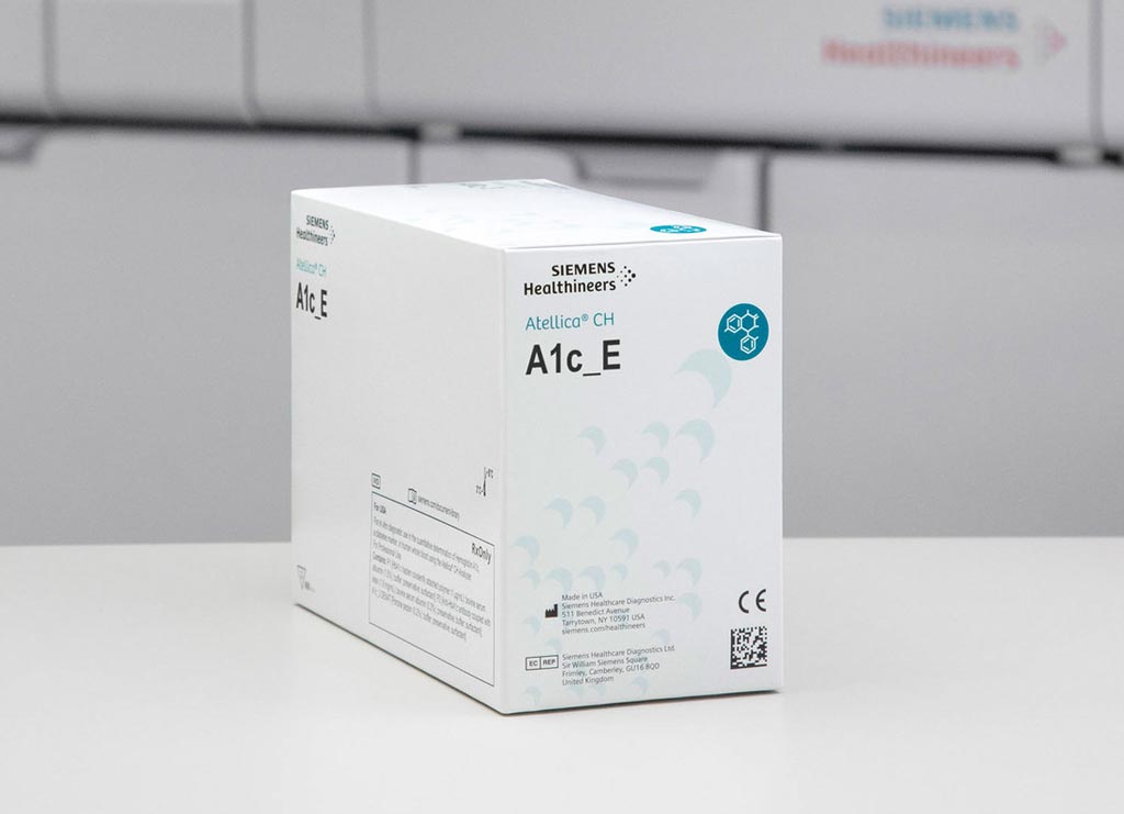 Imagen: El ensayo de hemoglobina enzimática A1c (A1c_E) Atellica CH (Fotografía cortesía de Siemens Healthineers).