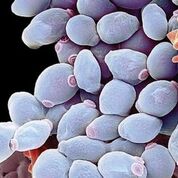 Imagen: Una fotomicrografía electrónica de barrido de las células de la levadura Candida albicans (Fotografía cortesía de Science Photo Library).