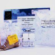 Imagen: El kit de aislamiento de ADN, UltraClean BloodSpin, diseñado para aislar ADN genómico y mitocondrial de sangre total (fresca, congelada o almacenada a 4°C), de la capa de glóbulos blancos o de las células cultivadas (Fotografía cortesía de MO BIO Laboratories).
