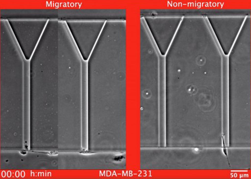 Imagen: Ejemplos de células de cáncer de mama, MDA-MB-231, migratorias y no migratorias mientras migran en el dispositivo MAqCI (Ensayo Microfluídico para la cuantificación de la invasión celular) (Fotografía cortesía de Christopher L. Yankaskas, Universidad Johns Hopkins).
