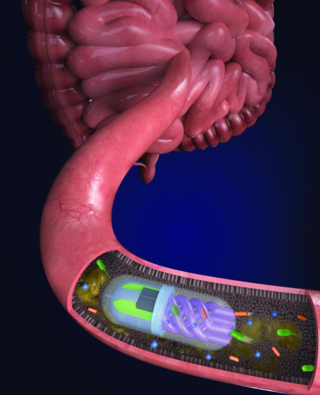 Imagen: Las bacterias intestinales son atraídas hacia los canales helicoidales por una “bomba” osmótica generada por una cámara llena de sal de calcio dentro de la píldora (Fotografía cortesía de Nano Lab, Universidad de Tufts).