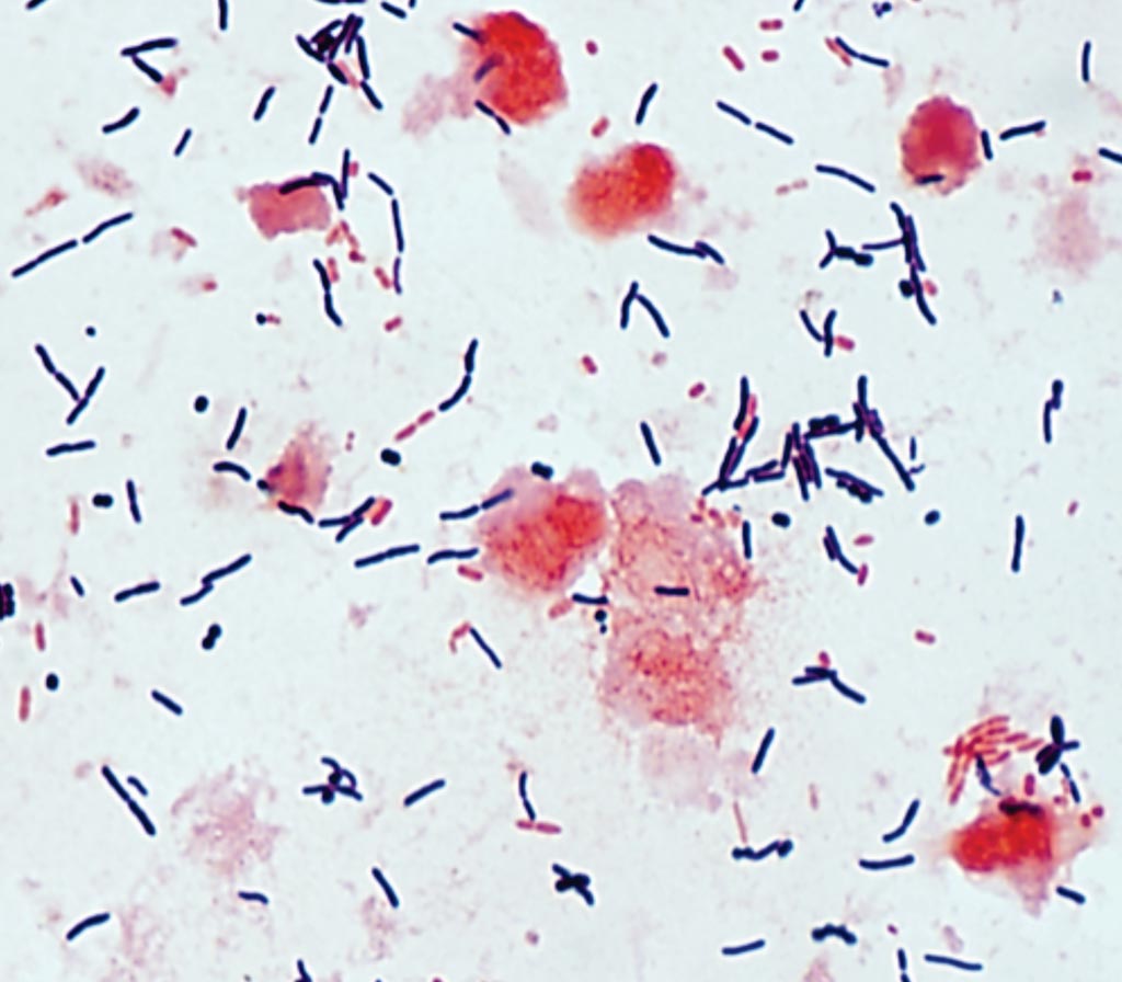 Imagen: Una microfotografía de una coloración de Gram de Clostridioides difficile toxigénico de una muestra de heces (Fotografía cortesía de la Universidad de Washington).