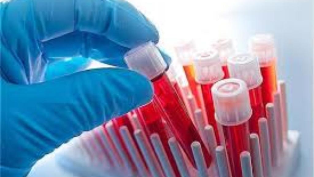 Imagen: Se espera que el mercado mundial de diagnósticos de hematología crezca a 5.590 millones de dólares para 2026, impulsado por la creciente aparición de trastornos sanguíneos y una mayor adopción de procesos de prueba automatizados (Fotografía cortesía de iStock). Imagen: Se espera que el mercado mundial de diagnósticos de hematología crezca a 5.590 millones de dólares para 2026, impulsado por la creciente aparición de trastornos sanguíneos y una mayor adopción de procesos de prueba automatizados (Fotografía cortesía de iStock).