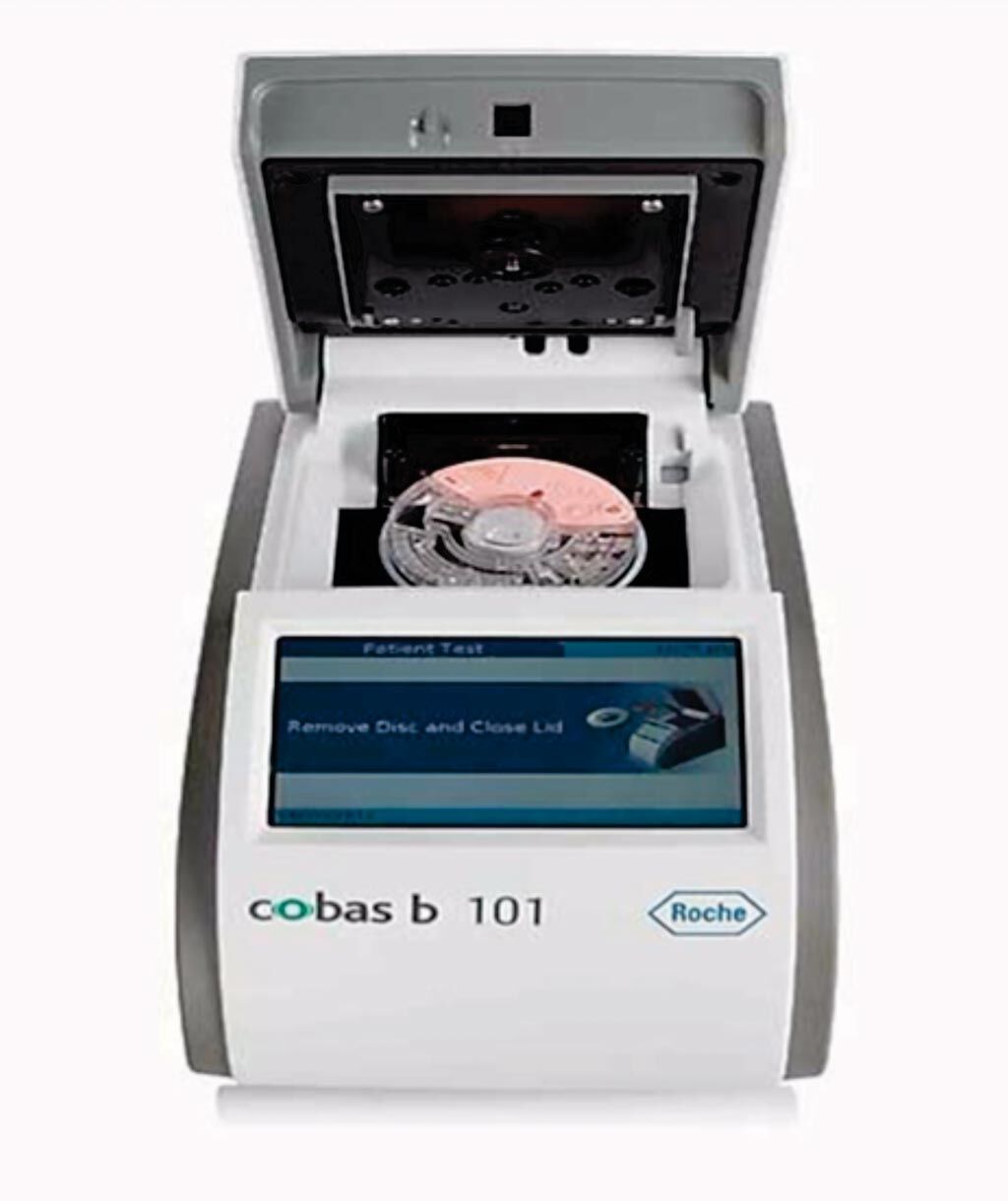 Imagen: El sistema cobas b 101 POC; un sistema de prueba de diagnóstico in vitro (IVD) que ofrece las mediciones de proteína C reactiva, HbA1c y un perfil completo de lípidos (CHOL, HDL, LDL, TG) en un dispositivo para los puntos de atención (Fotografía cortesía de Roche Diagnostics).