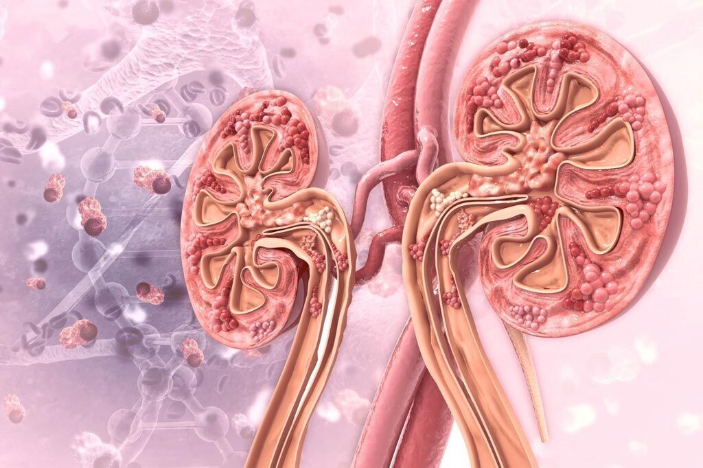 Imagen: Un estudio nuevo sugiere que los pacientes con gota tienen un riesgo elevado de enfermedad renal crónica (Fotografía cortesía de Shutterstock). Imagen: Un estudio nuevo sugiere que los pacientes con gota tienen un riesgo elevado de enfermedad renal crónica (Fotografía cortesía de Shutterstock).