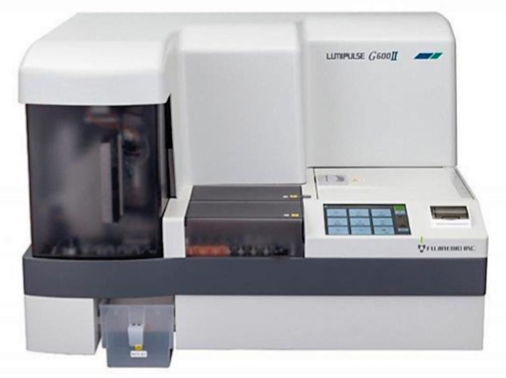 Imagen: El Lumipulse G600 II es un analizador de inmunoensayo enzimático quimioluminiscente de mesa totalmente automatizado (Fotografía cortesía de Fujirebio Europa).