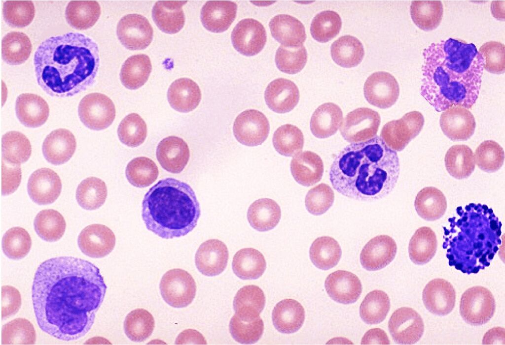 Imagen: Un extendido de sangre que muestra neutrófilos y linfocitos y otros leucocitos y eritrocitos y una plaqueta (Fotografía cortesía de la Universidad de Minnesota).