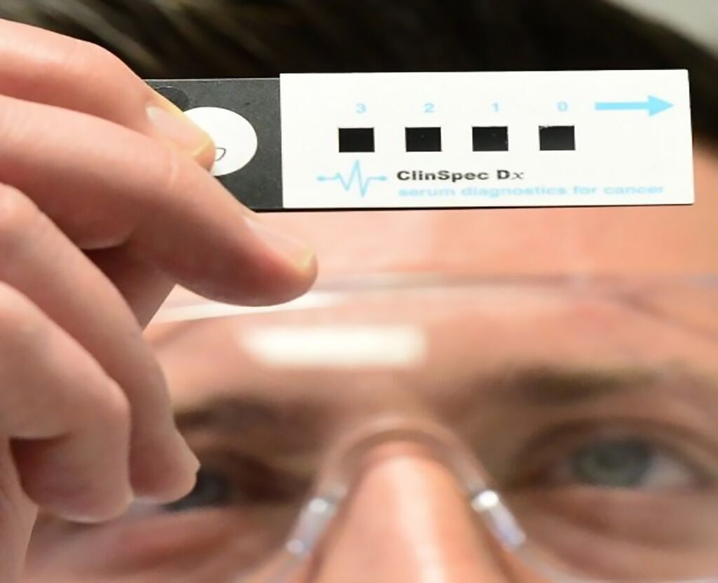 Imagen: La nueva prueba de ClinSpec Diagnostics puede diagnosticar el cáncer de cerebro con una muestra de sangre (Fotografía cortesía de la Universidad de Strathclyde).